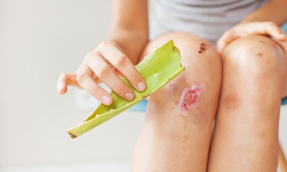 Tips and Tricks To Help a Wound Heal Faster